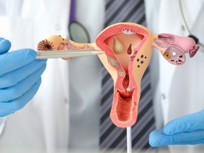 Pap Smear Untuk Mendeteksi Kanker Serviks