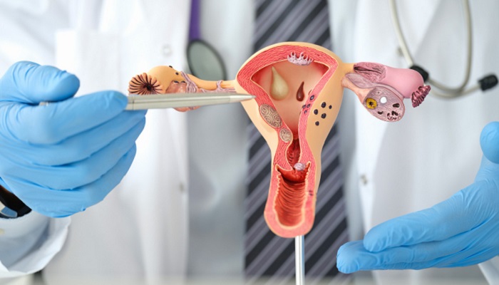 Pap Smear Untuk Mendeteksi Kanker Serviks