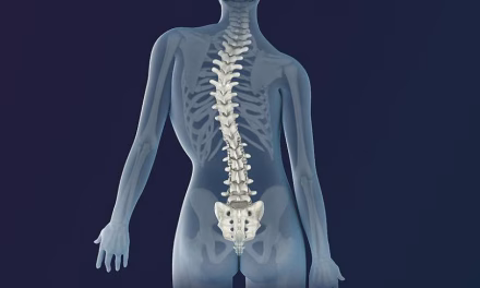 Kelainan Tulang Belakang Atau Skoliosis Pada Seseorang
