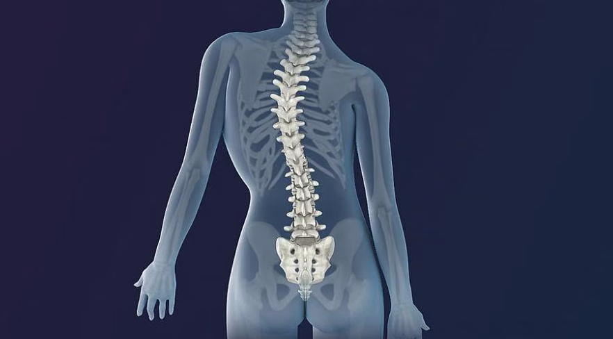 Kelainan Tulang Belakang Atau Skoliosis Pada Seseorang