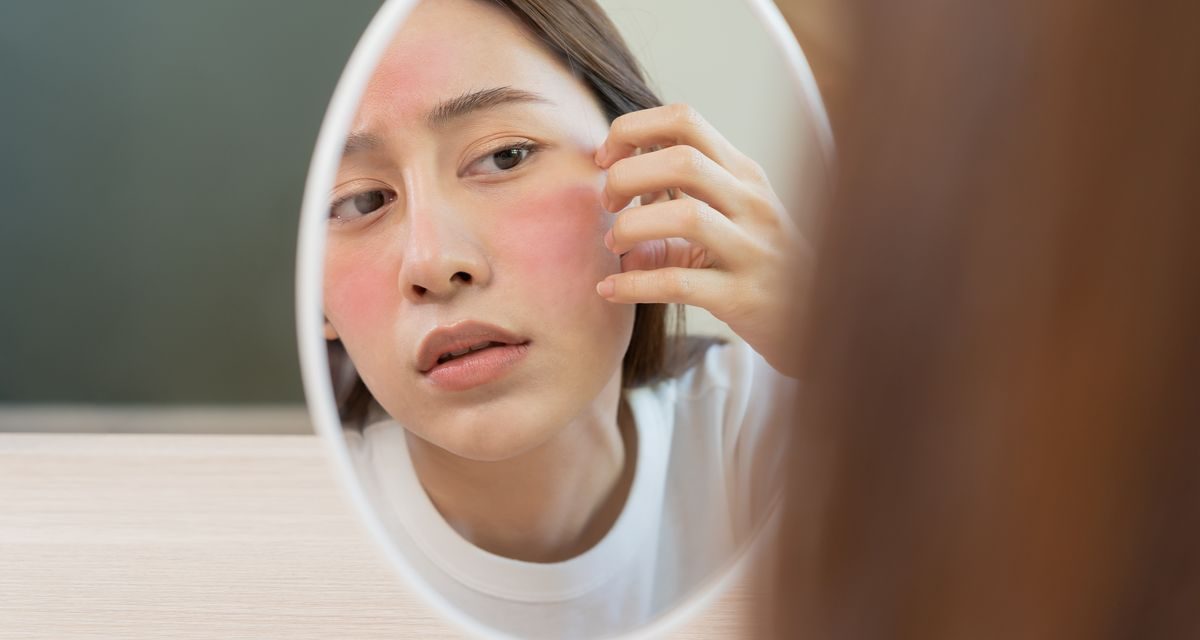 Kebiasaan Sepele Yang Bikin Kulit Kering Kerontang