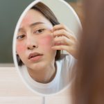 Kebiasaan Sepele Yang Bikin Kulit Kering Kerontang