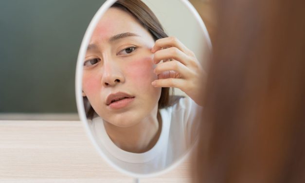 Kebiasaan Sepele Yang Bikin Kulit Kering Kerontang