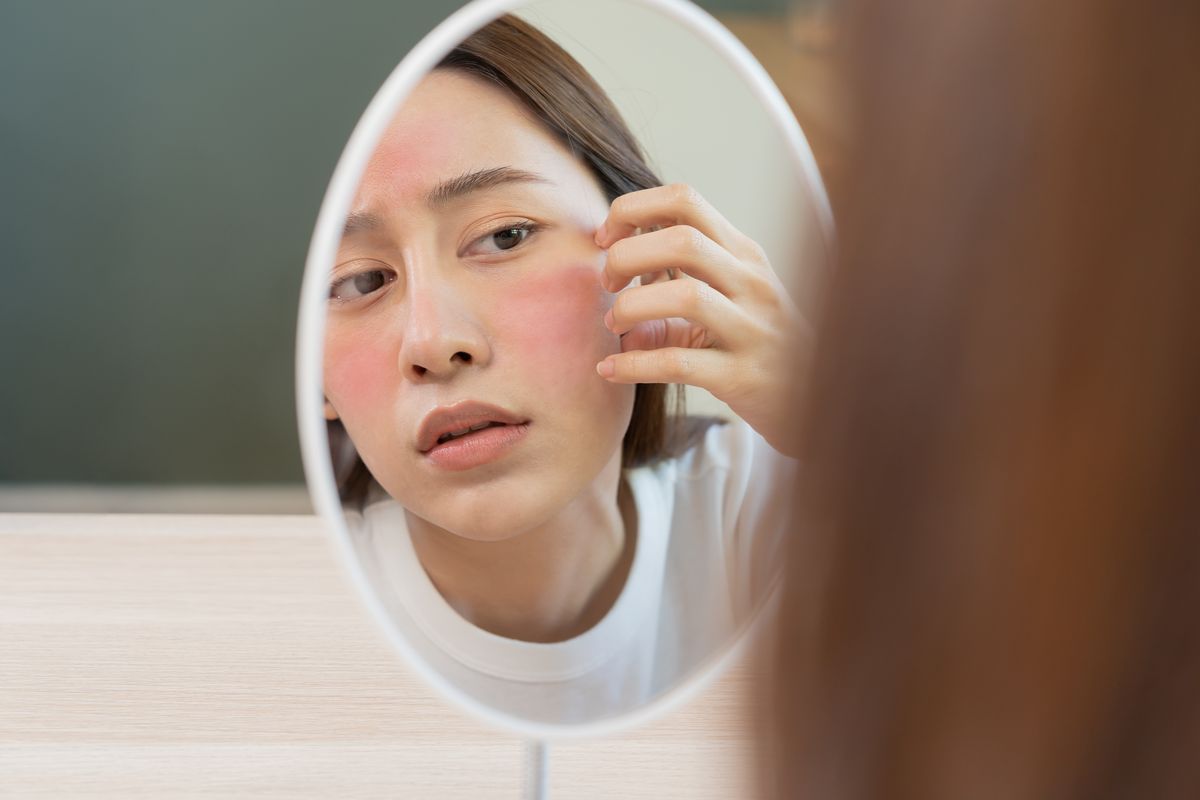 Kebiasaan Sepele Yang Bikin Kulit Kering Kerontang
